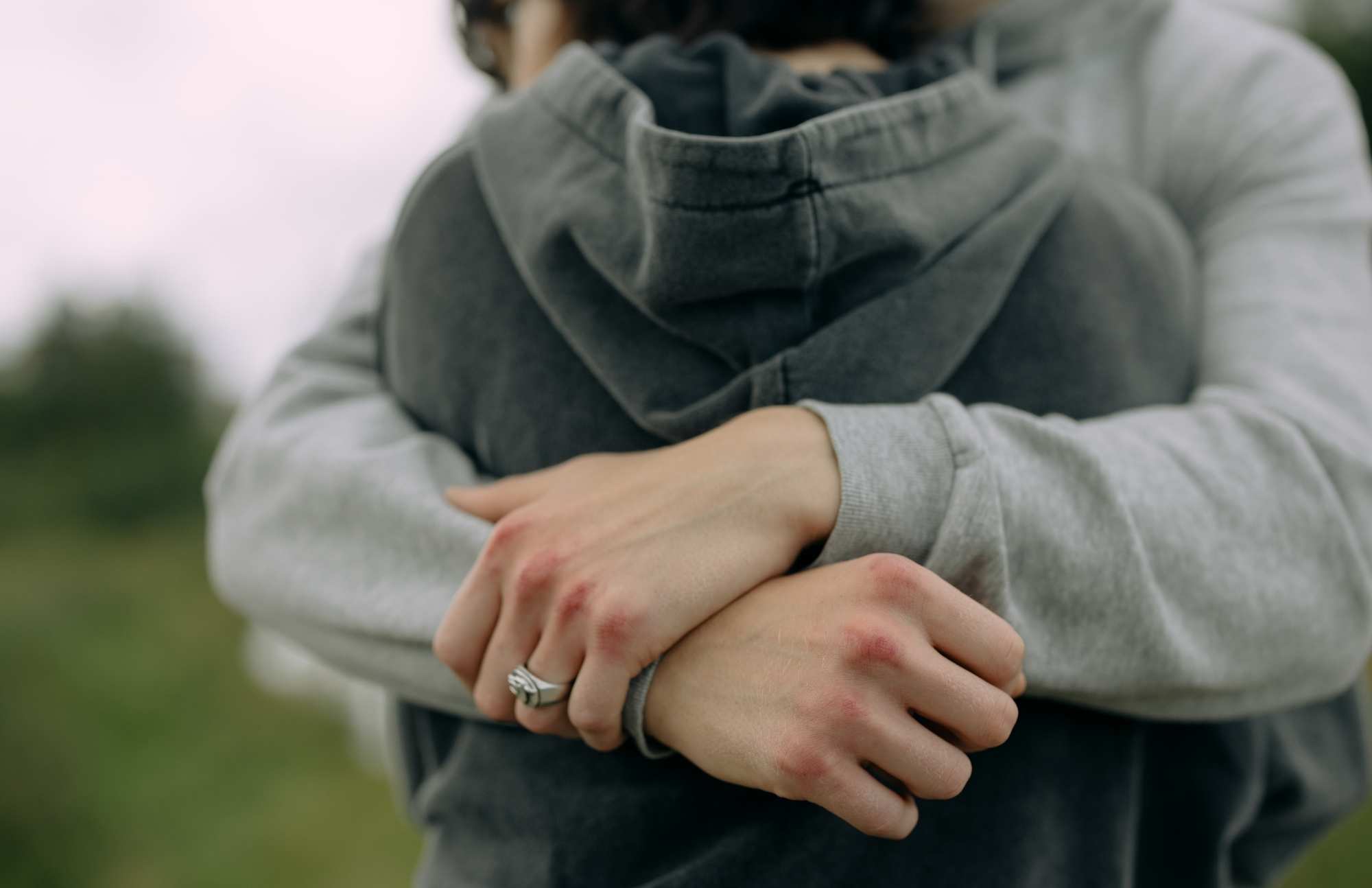 Close-up of a couple holding hands, emphasizing the importance of STD testing for maintaining safe and healthy relationships.