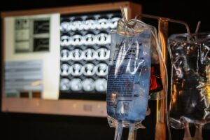 How Long Do IV Drip Benefits Last?